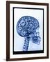 X-ray of skull with gears-Thom Lang-Framed Photographic Print