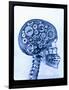 X-ray of skull with gears-Thom Lang-Framed Photographic Print