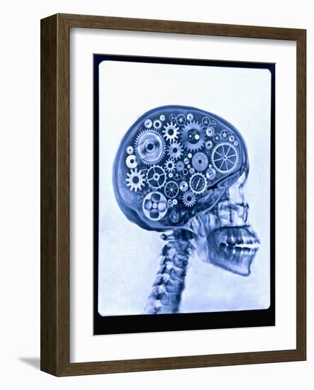 X-ray of skull with gears-Thom Lang-Framed Photographic Print