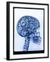 X-ray of skull with gears-Thom Lang-Framed Photographic Print