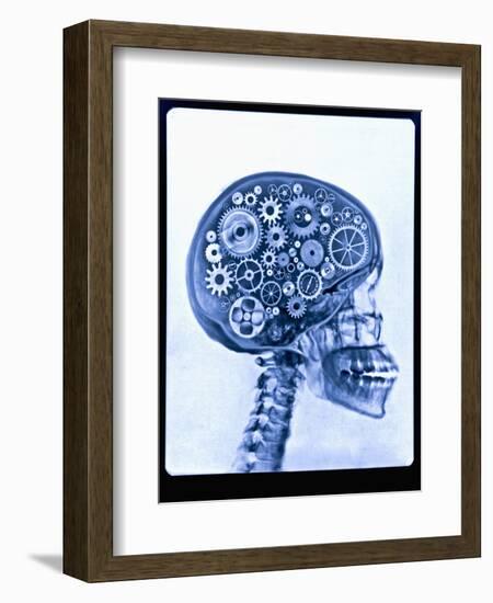 X-ray of skull with gears-Thom Lang-Framed Photographic Print