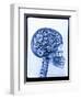 X-ray of skull with gears-Thom Lang-Framed Photographic Print