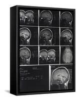 X-Ray Photographs of Person's Skull-null-Framed Stretched Canvas