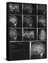 X-Ray Photographs of Person's Skull-null-Framed Stretched Canvas