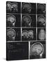 X-Ray Photographs of Person's Skull-null-Stretched Canvas