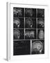 X-Ray Photographs of Person's Skull-null-Framed Photographic Print