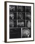 X-Ray Photographs of Person's Skull-null-Framed Photographic Print