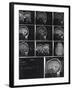 X-Ray Photographs of Person's Skull-null-Framed Photographic Print