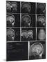 X-Ray Photographs of Person's Skull-null-Mounted Photographic Print