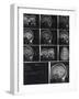 X-Ray Photographs of Person's Skull-null-Framed Photographic Print