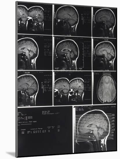 X-Ray Photographs of Person's Skull-null-Mounted Photographic Print