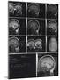 X-Ray Photographs of Person's Skull-null-Mounted Photographic Print