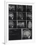 X-Ray Photographs of Person's Skull-null-Framed Photographic Print