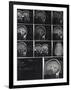 X-Ray Photographs of Person's Skull-null-Framed Photographic Print