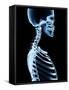 X-Ray Skeleton on Black-posteriori-Framed Stretched Canvas