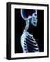 X-Ray Skeleton on Black-posteriori-Framed Art Print