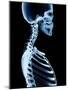 X-Ray Skeleton on Black-posteriori-Mounted Art Print