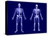 X-Ray Skeleton on Blue-AlienCat-Stretched Canvas