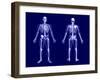 X-Ray Skeleton on Blue-AlienCat-Framed Art Print