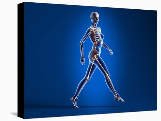 X-Ray View of a Naked Woman Walking, with Skeletal Bones Superimposed-null-Stretched Canvas