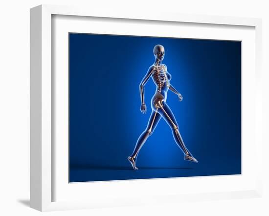 X-Ray View of a Naked Woman Walking, with Skeletal Bones Superimposed-null-Framed Art Print