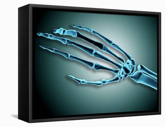 X-Ray View of Bones in Human Hand-null-Framed Stretched Canvas