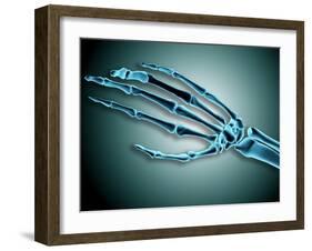 X-Ray View of Bones in Human Hand-null-Framed Art Print