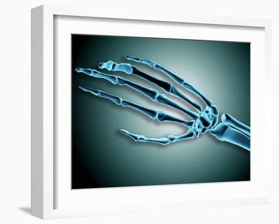 X-Ray View of Bones in Human Hand-null-Framed Art Print