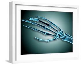 X-Ray View of Bones in Human Hand-null-Framed Art Print