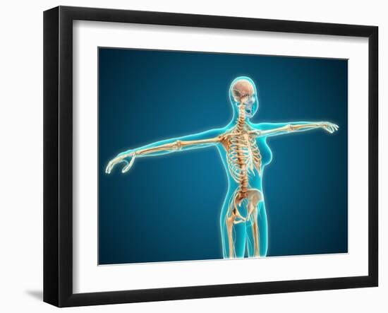 X-Ray View of Female Body Showing Skeletal System-null-Framed Art Print