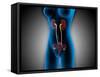 X-Ray View of Female Body with Reproductive Organs-null-Framed Stretched Canvas
