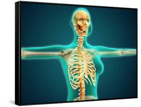 X-Ray View of Female Upper Body Showing Rib Cage, Spine and Skull-null-Framed Stretched Canvas