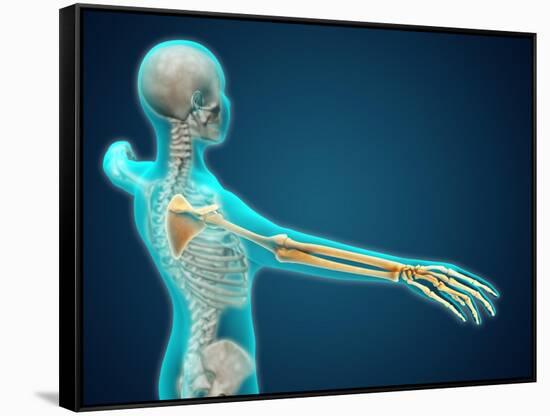 X-Ray View of Human Body Showing Skeletal Bones in the Arm and Hand-null-Framed Stretched Canvas