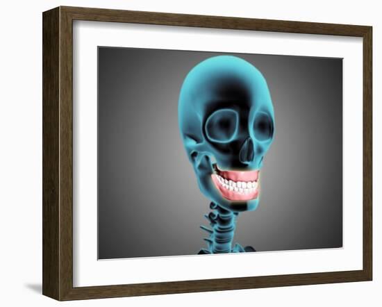X-Ray View of Human Skeleton Showing Teeth and Gums-null-Framed Art Print