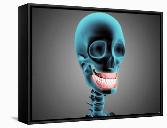 X-Ray View of Human Skeleton Showing Teeth and Gums-null-Framed Stretched Canvas