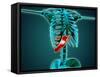 X-Ray View of Human Skeleton with Liver-null-Framed Stretched Canvas