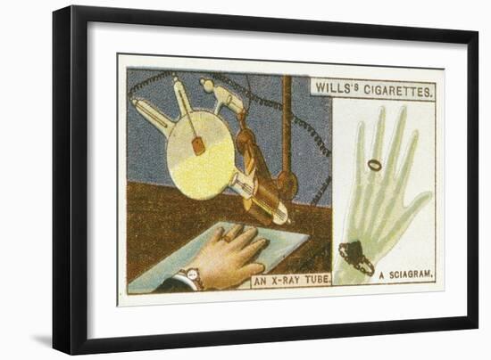 X-Raying the Hand, 1924-null-Framed Giclee Print