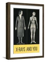 X-Rays and You-null-Framed Giclee Print