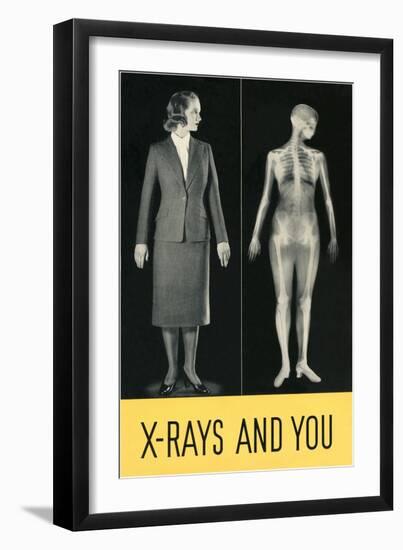 X-Rays and You-null-Framed Giclee Print