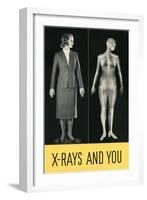 X-Rays and You-null-Framed Giclee Print