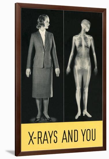 X-Rays and You-null-Framed Giclee Print