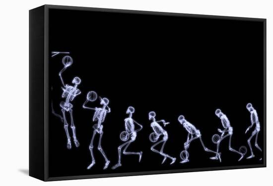Xray of Human Skeleton Playing Basketball-riccardocova-Framed Stretched Canvas