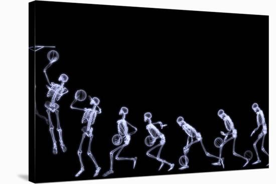 Xray of Human Skeleton Playing Basketball-riccardocova-Stretched Canvas