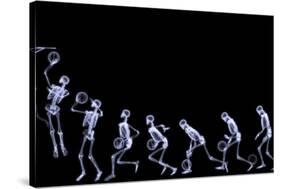 Xray of Human Skeleton Playing Basketball-riccardocova-Stretched Canvas