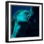 Young Caucasian Couple in Love at Twilight Light-Serg Zastavkin-Framed Photographic Print