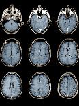 Normal Brain, MRI Scans-ZEPHYR-Framed Photographic Print