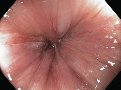 Résultat de recherche d'images pour "anus plein de fleurs"