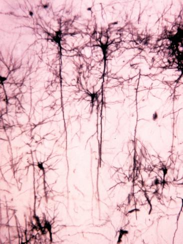 Neurons of the Cerebral Cortex Showing the Dendrites; Cell Bodies; and