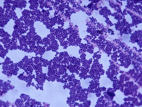 Staphylococcus Aureus Bacteria, Gram-Positive Cocci, LM X500 Impressão ...