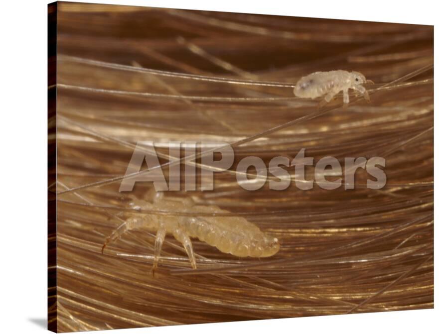 Head Lice Crawling Through Hair Photographic Print Darlyne A Murawski Allposters Com